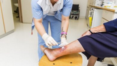 Cute Nurse with tatoo on her forearm is changing bandage to a patient with venous insufficiency ulceration...wheel chair on back