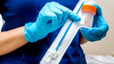 Gynecologist holds a brush for sampling liquid cytology