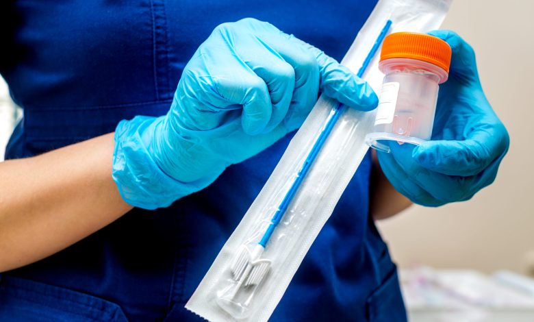 Gynecologist holds a brush for sampling liquid cytology